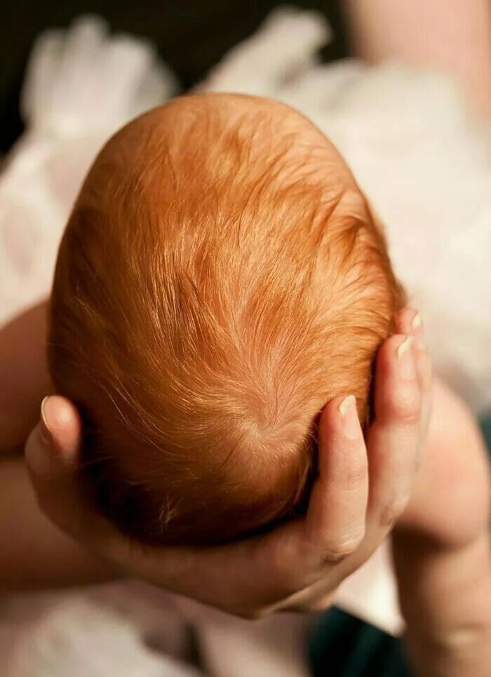 Рыжий новорожденный. Младенец с волосами. Рыжие Новорожденные.