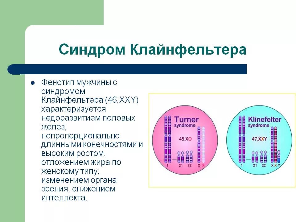 Синдромы болезни клайнфельтера. Клинические симптомы клайнфельтера. Синдром кляин-фельтерп. Причина появления синдрома клайнфельтера. Синдром клайнфельтера с умственной отсталостью.
