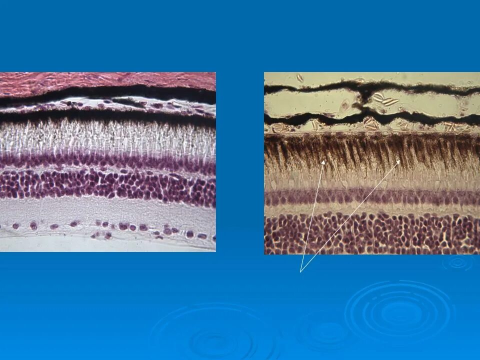 Сетчатка гистология. Сетчатка глаза гистология препарат на свету и в темноте. Сетчатка гистология препарат. Пигментированный эпителий сетчатки.