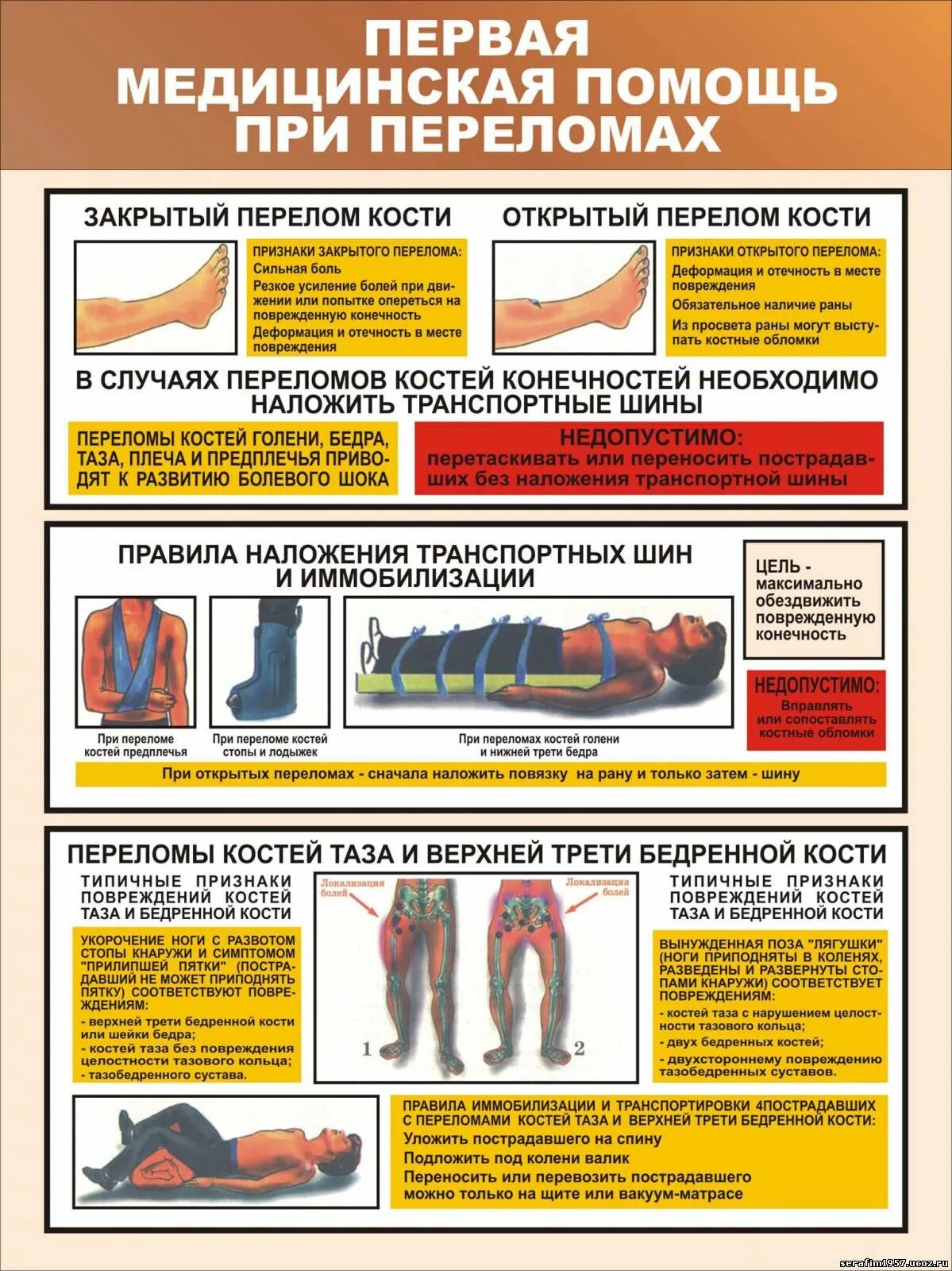 1 медицинская помощь при травме. Оказание первой помощи при переломах костей конечностей. Переломы оказание ПМП при переломах. Переломы костей конечностей действия по оказанию первой помощи. Порядок оказания первой помощи при переломе нижних конечностей.