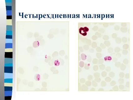 Лабораторная диагностика малярии