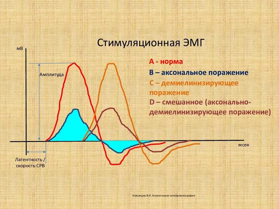 Амплитуда тест