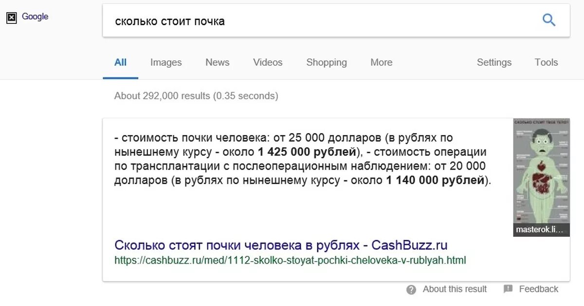 Сколько дают за продажу. Сколько стоит почка. За сколько можно продать почку. Сколько стоит продать почку человека. Сколько стоит продать почку в России.