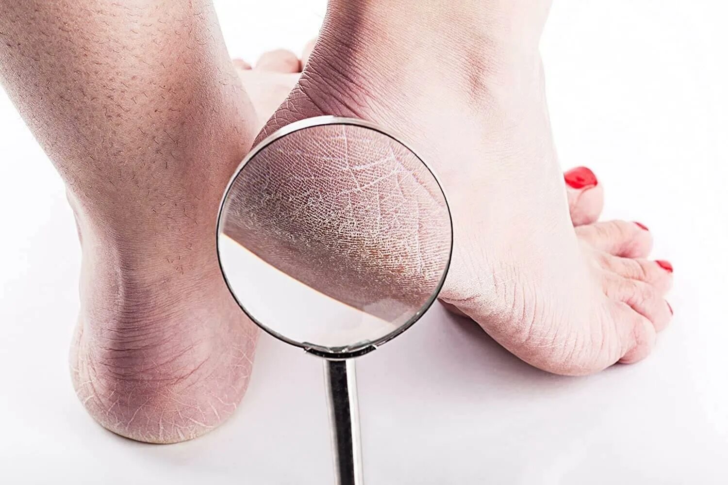 Проблема пяток. Koelf патч callus care heel 1 пара. патчи для пяток корея. callus care heel patch.