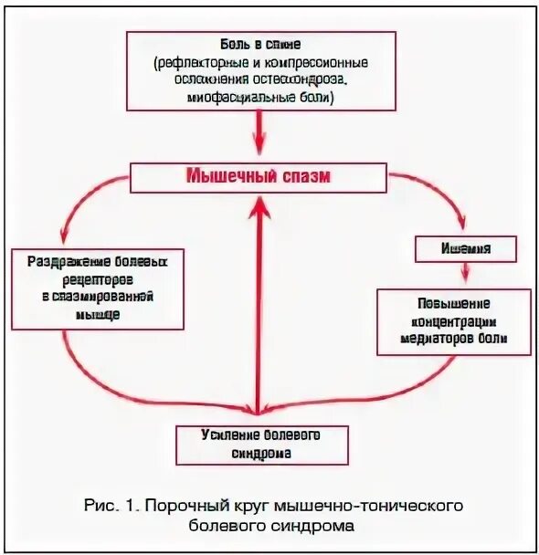 Рефлекторные мышечные синдромы. Рефлекторные мышечные синдромы
