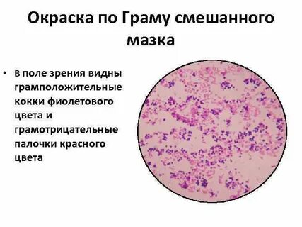 Грам кокки