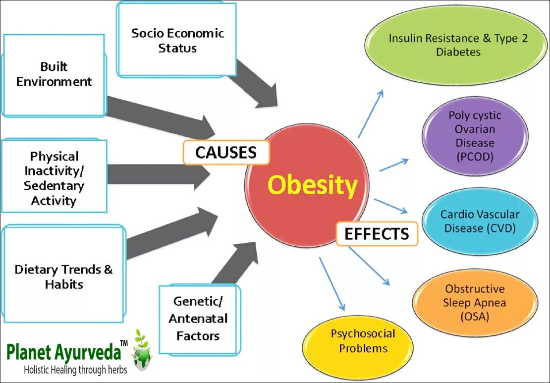 Obesity causes. Causes of obesity. Obesity reasons. Physical inactivity. Anasazi-cause and consequences.