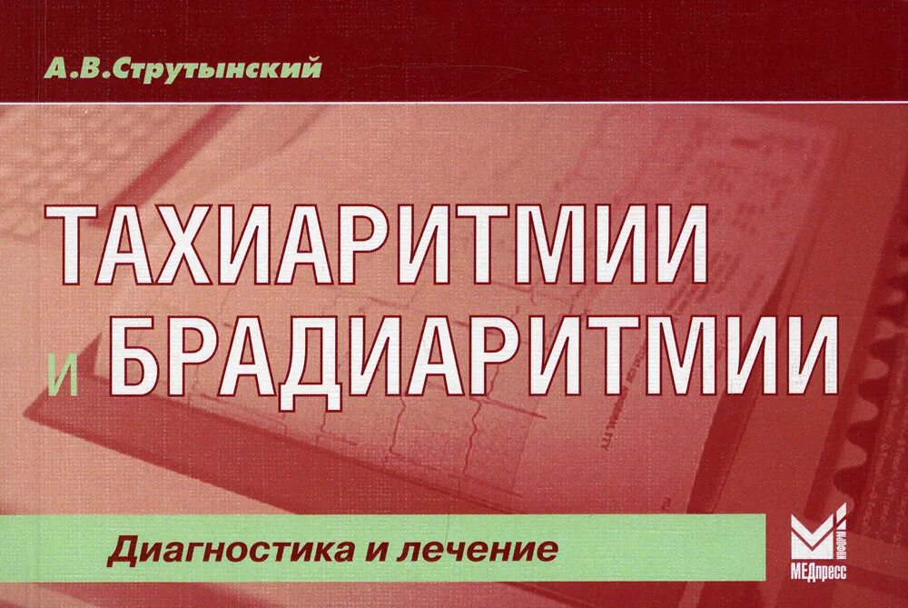 Тахиаритмия лечение. Препараты при желудочковых тахиаритмиях. Тахиаритмия лечение. Классификация тахиаритмий. Классификация аритмий тахиаритмий.