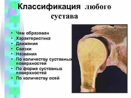 Артрология