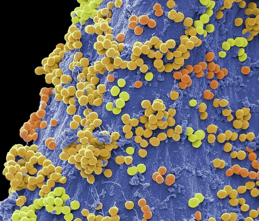 Стафилококк презентация. Стафилококк сообщение. Сапрофитный стафилококк. Самые вредные бактерии. Морфотип стафилококк.