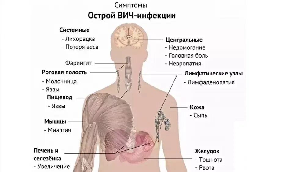 Первые симптомы вич инфекции