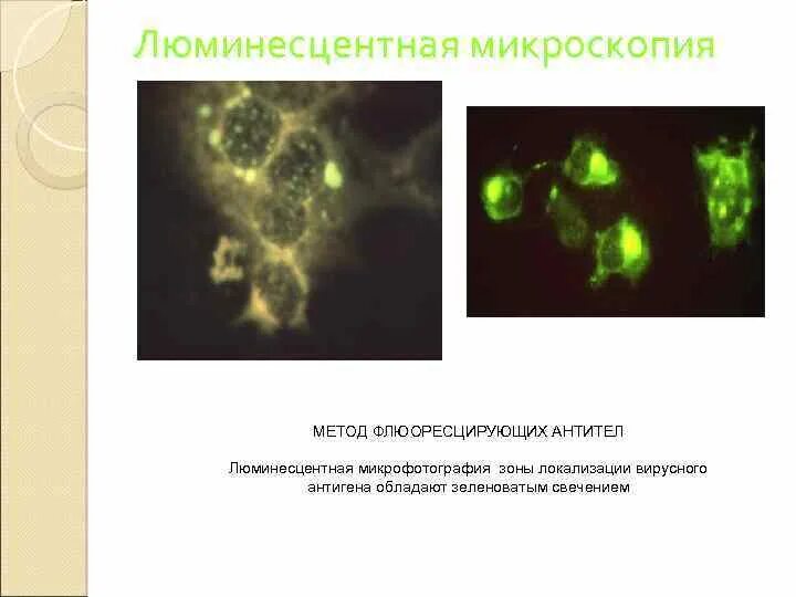 (Люминесцентная) микроскопия. Люминесцентная микроскопия. МФА метод флюоресцирующих антител. Люминесцентная микроскопия микробиология. Бешенство люминесцентная микроскопия. Называют обладают флюоресцируют