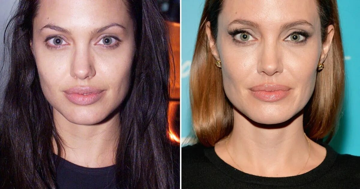 анжелина джоли до и после пластики. анджелина джоли ринопластика. анджелина джоли пластика. анджелина джоли до операции. анджелина джоли ринопластика.