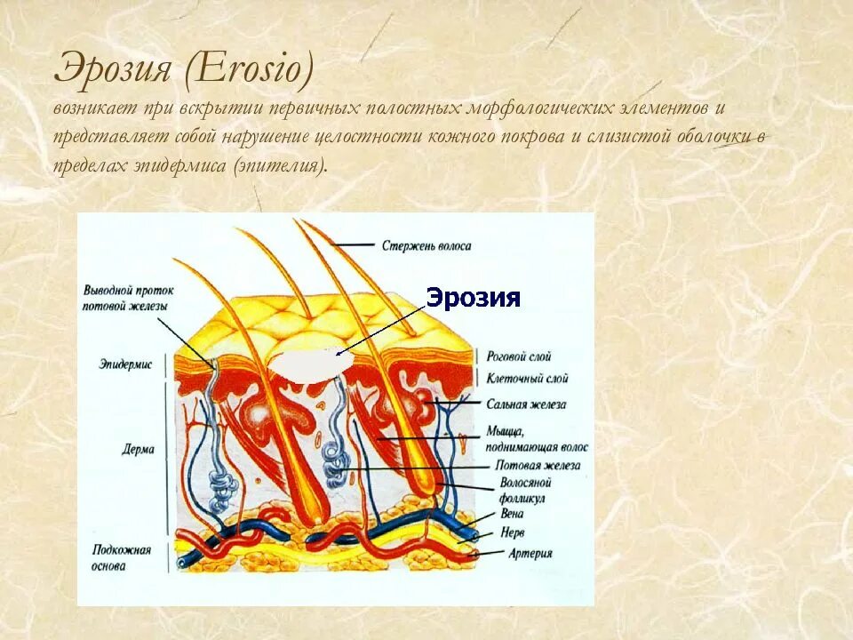 Пятно первичный элемент. Первичные и вторичные элементы кожи. вторичные морфологические элементы кожи. полостные элементы кожи. первичные полостные морфологические элементы кожи.