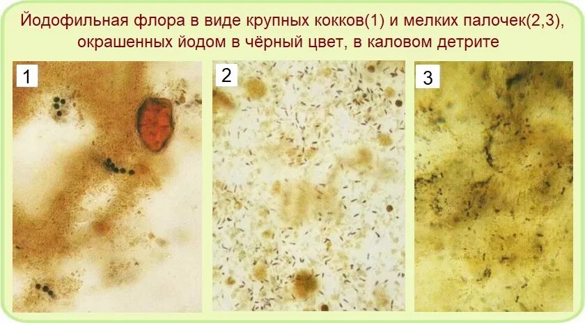 Что значит в копрограмме грибы