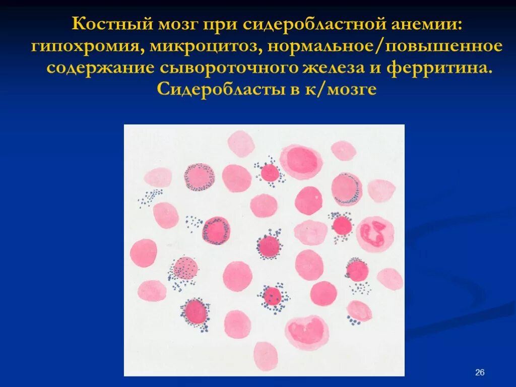 Гипохромия железодефицитная анемия. Сидероциты и сидеробласты. Сидеробластная анемия кровь. Сидеробластные анемии картина крови. Сидеробластная анемия мазок крови.