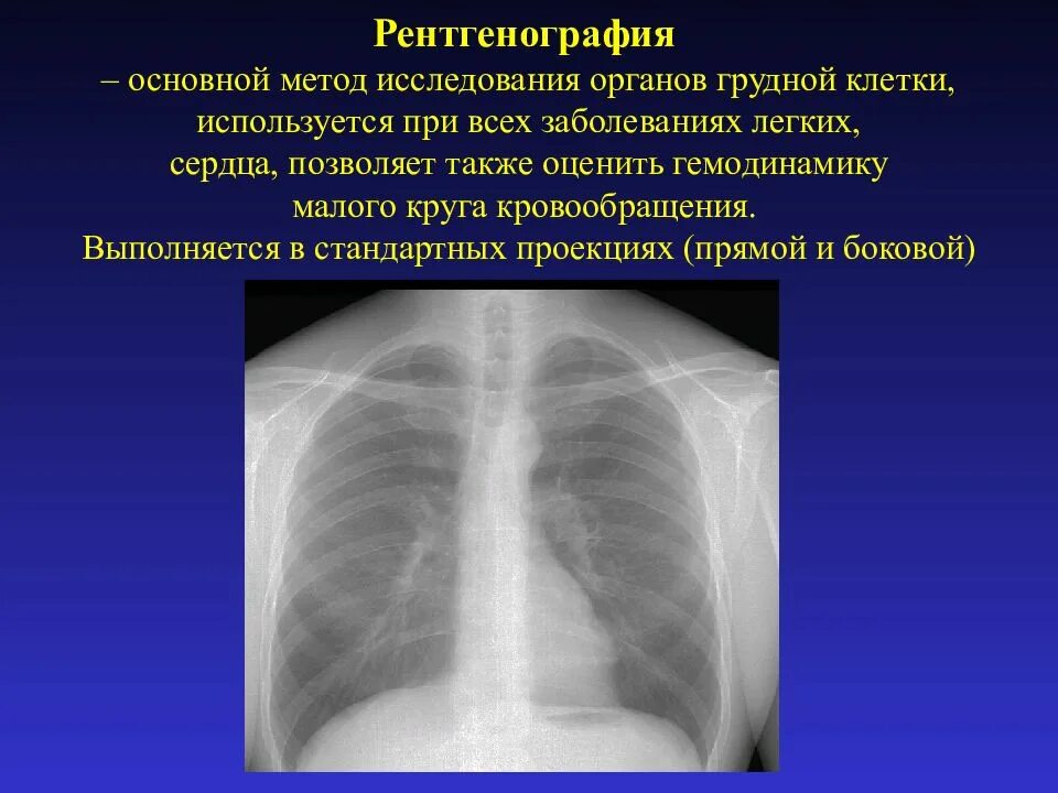 Заболевания грудной полости. Методы рентгенологического исследования органов грудной клетки. Рентгенограмма органов грудной клетки. Рентгенология органов грудной клетки. Обзорный рентген органов грудной клетки.