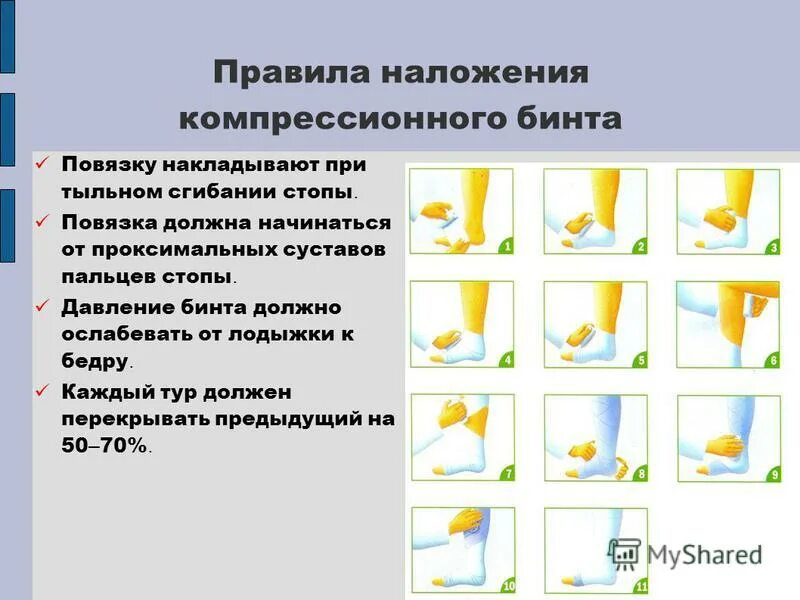 Эластическая компрессия нижних конечностей алгоритм. Эластическая компрессия нижних конечностей алгоритм. Техника эластичной компрессии нижних конечностей. Эластическая компрессия нижних конечностей алгоритм. Эластическая компрессия нижних конечностей алгоритм.
