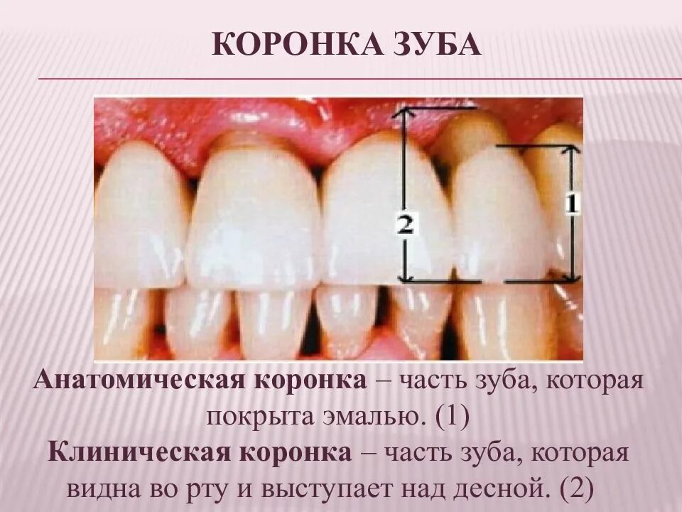 Анатомическая и клиническая коронка зуба. Анатомическая коронка зуба это. Клиническая коронка и анатомическая коронка зуба. Видимая часть зуба