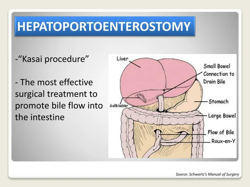 Into procedure