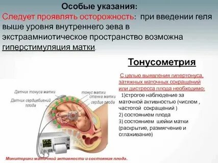 Тонус матки уколы