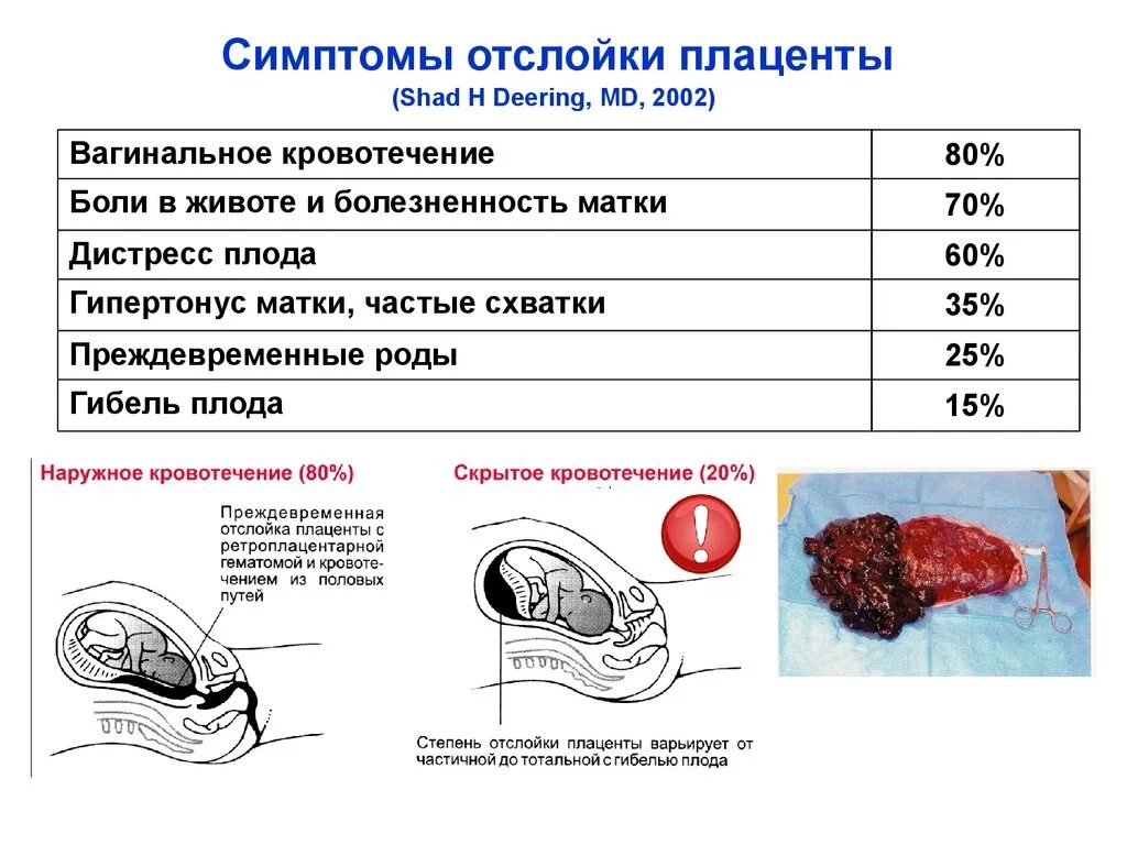 Схватки без пробки