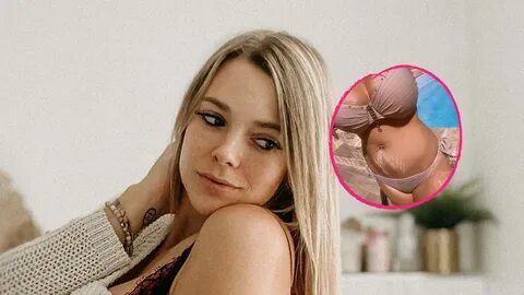 Mutiges Bild: Anne Wünsche steht zu ihren Dehnungsstreifen.