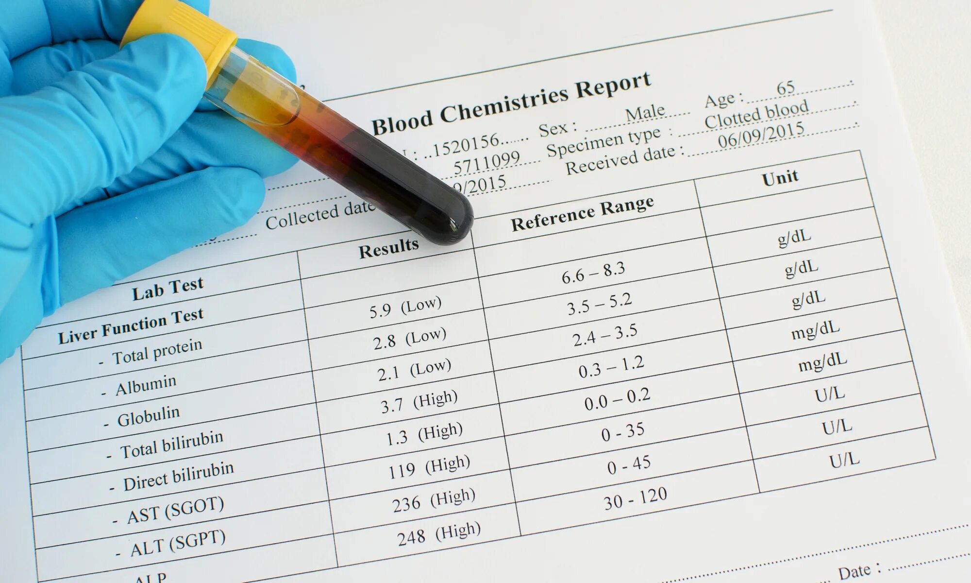 The results of the tests are