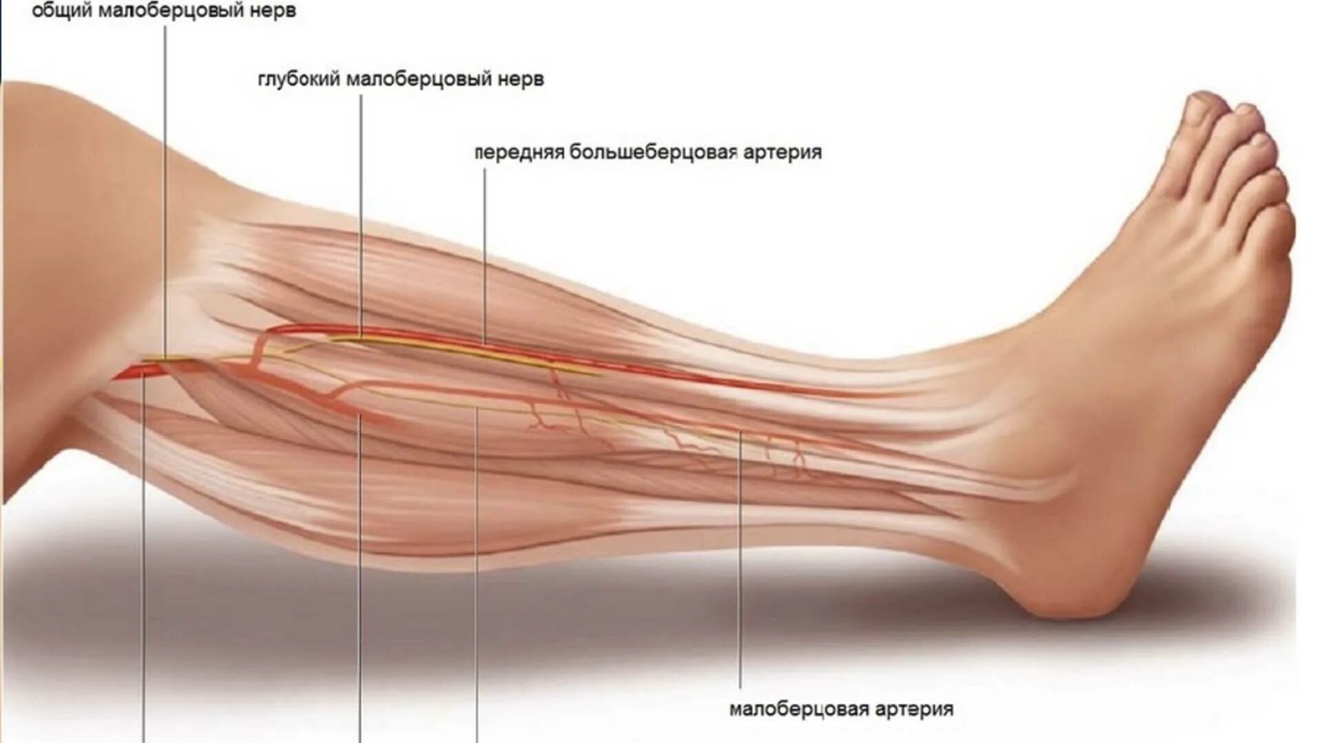 Малоберцовый нерв стопа. Малоберцовый нерв анатомия. Невропатия малоберцового нерва клиника. Нейропатия малоберцового нерва нерва. Нейропатии большеберцового малоберцового нерва.