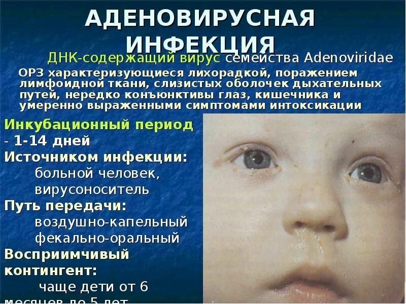 Насморк конъюнктивит температура у ребенка