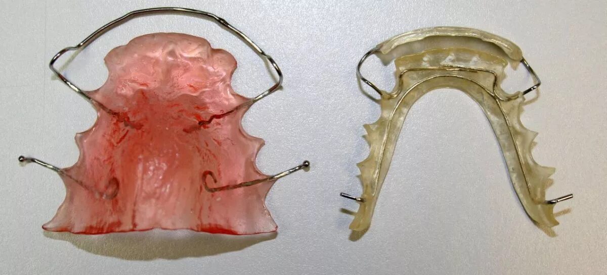 Hawley ретейнер. Ретенционный ортодонтический аппарат. Несъемный ретенционный аппарат. Съёмный ретейнер пластинка. Аппарат хасса