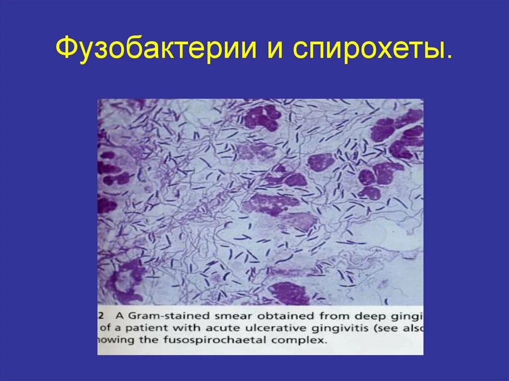 Микрофлора языка. Фузобактерии микробиология иммунитет. Микрофлора зубного налета микробиология. Микрофлора полости рта фузобактерии. Фузобактерии и спирохеты.