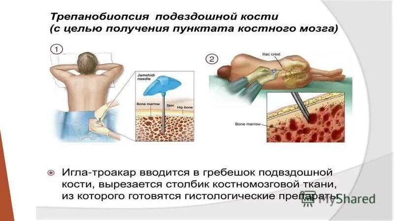 Костный мозг где находится