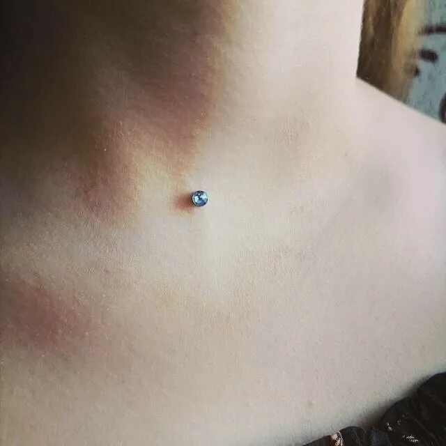 Имитация микродермала. Микродермал фф минсоны. Микродермал фф минсоны. Микродермал фф минсоны. Микродермал фф минсоны.