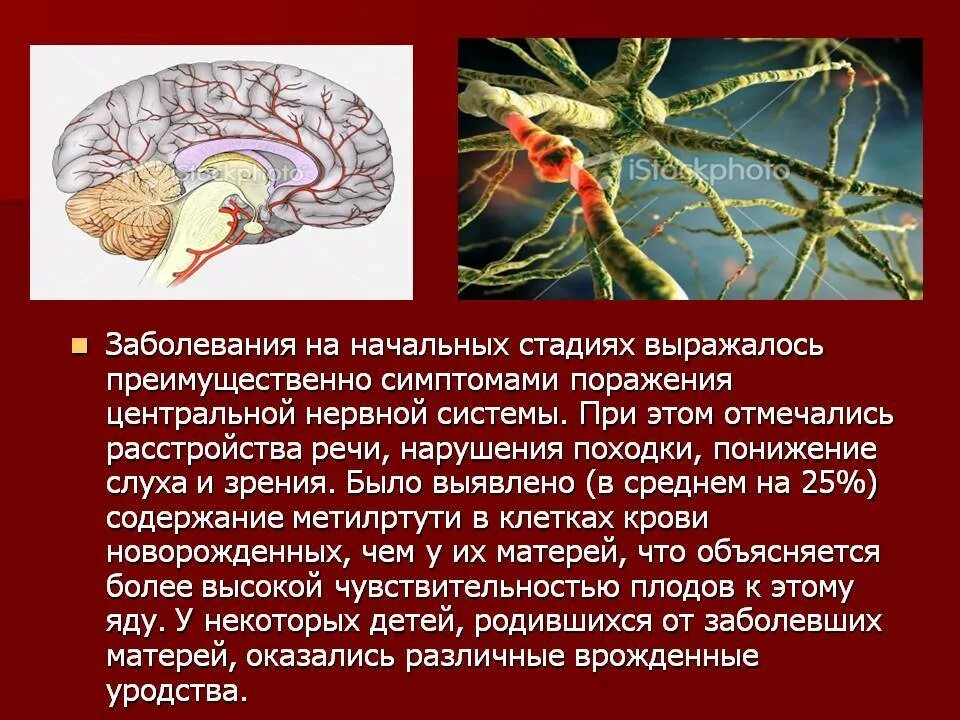 Симптомы поражения центральной. Поражение центральной нервной системы. Повреждение центральной нервной системы симптомы. Поражение центральной нервной системы у ребенка. Поражение центральной нервной системы мозга.