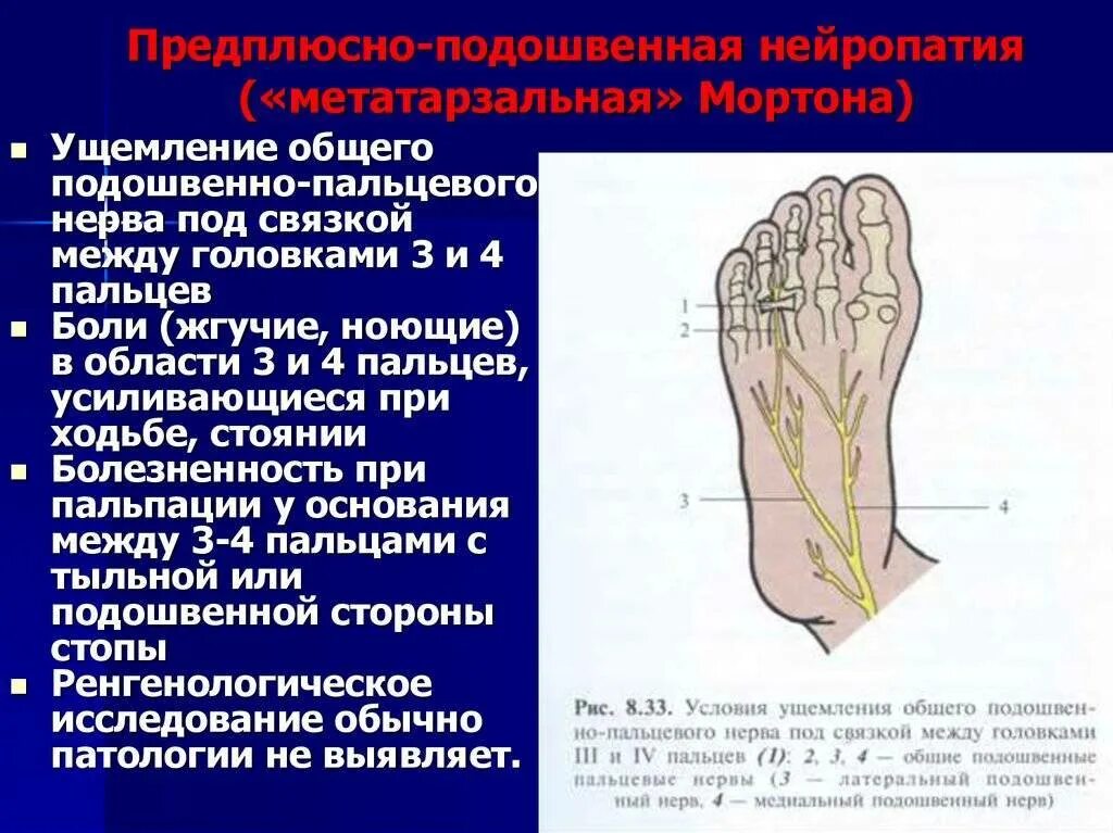 Нейропатия справа. Иннервация малоберцового нерва. Малоберцовый нерв иннервация кожи. Туннельный синдром большеберцового нерва. Нейропатии большеберцового малоберцового нерва.