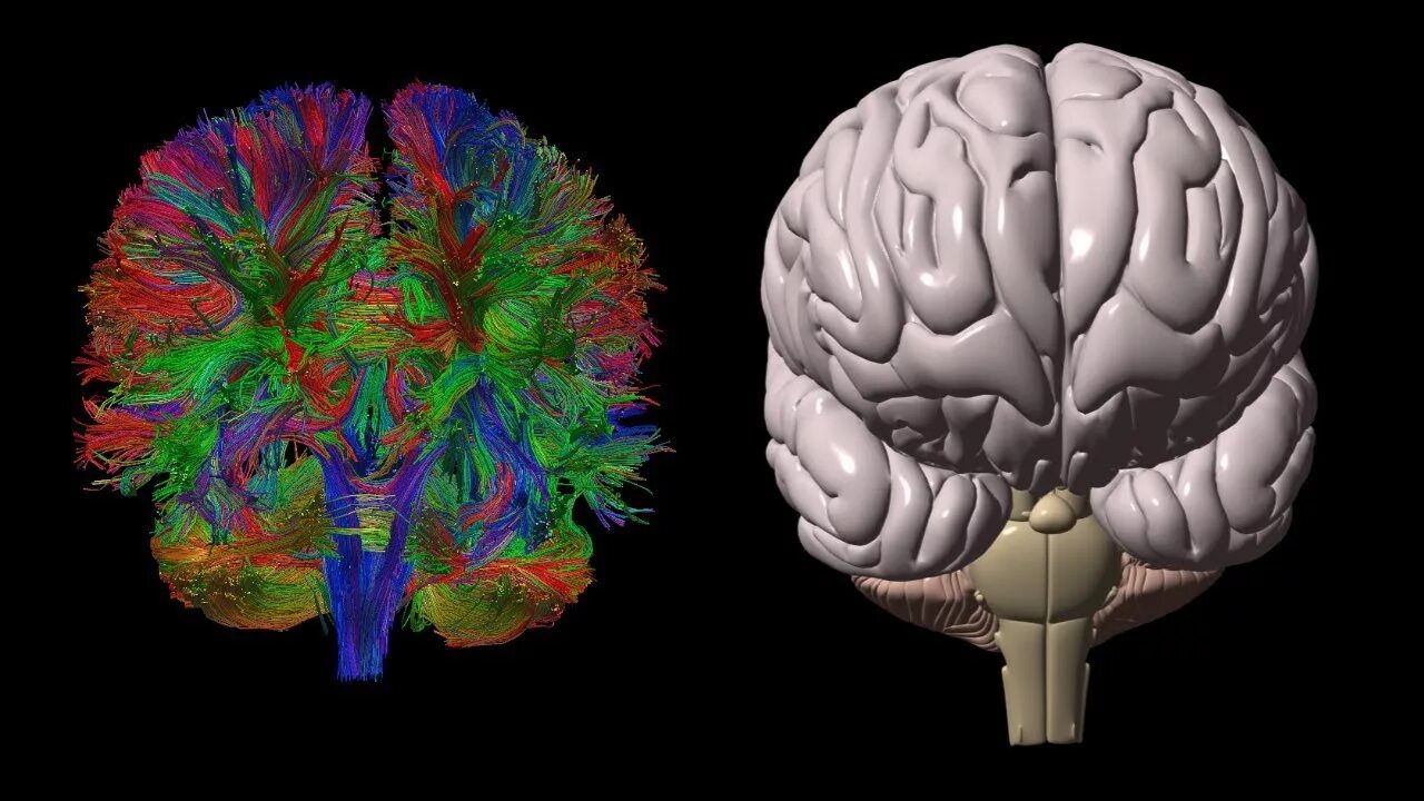 Диффузное пространство. Diffusion Tensor Imaging (DTI). Трактография головного мозга. Диффузионная тензорная визуализация. МР трактография головного мозга.