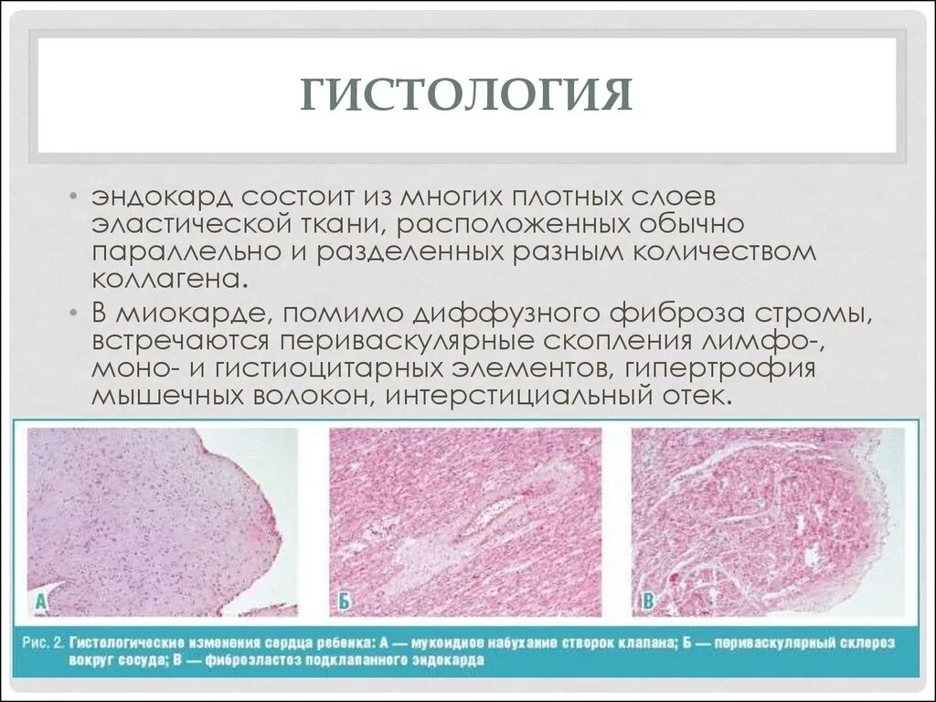 Гистологическое исследование шейки матки расшифровка. Гистология в гинекологии. Гистология анализ. Гистология исследование.