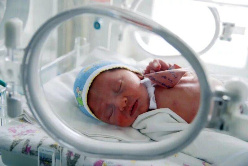 Недели ребенок жизнеспособен. Рождение недоношенных детей. Недоношенный ребёнок 34 недели. Недоношенный ребёнок 32 недели.
