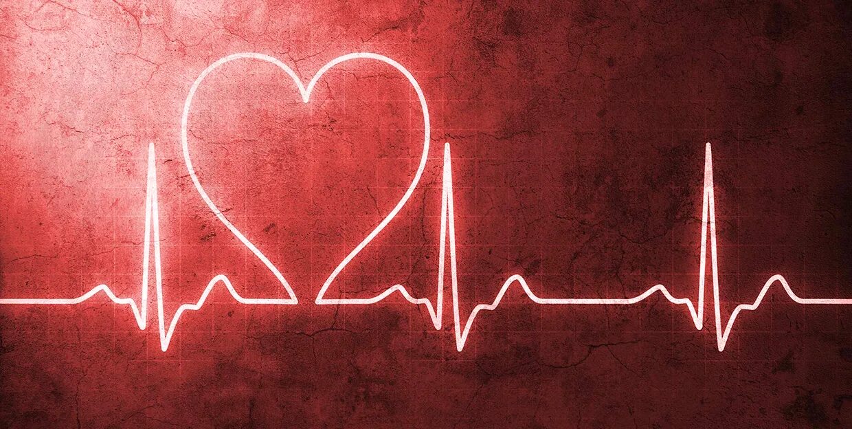 Сердцебиения 23. Аритмия сердца. Кардиограмма сердца. ЭКГ сердца. Красивая кардиограмма.