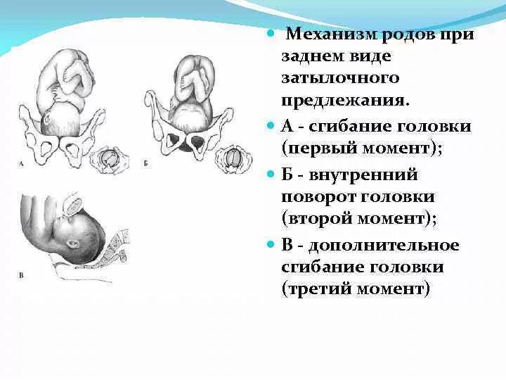 Задний вид затылочного предлежания биомеханизм родов. Механизм родов при переднем виде головного предлежания. Передний вид головного предлежания биомеханизм родов. Биомеханизм родов при заднем виде затылочного предлежания плода. Заднее предлежание плода