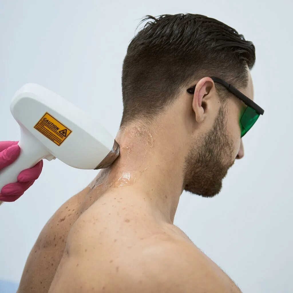 Лазер эпиляция мужчины. Лазерная эпиляция спины мужчины. Мужской лазер. Мужская лазерная депиляция. Эпиляция для мужчин.