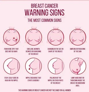 Early Stages Of Breast Cancer Symptoms.