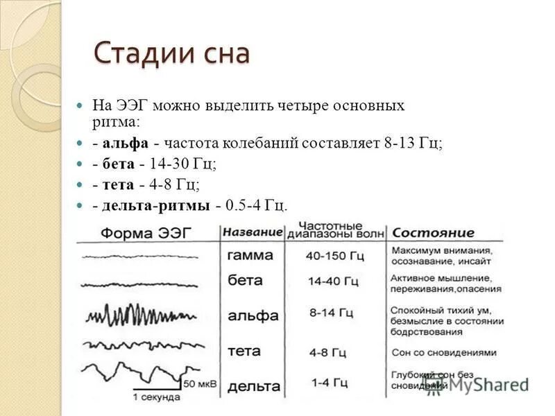 Ээг бодрствования. Фазы сна на ЭЭГ. Фазы сна по ритмам ЭЭГ. Фазы медленного сна ЭЭГ. Стадии сна параметры ЭЭГ.