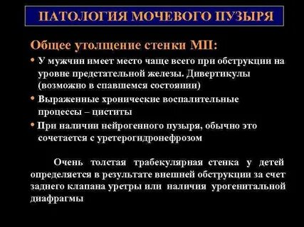 Утолщение стенок мочевого пузыря