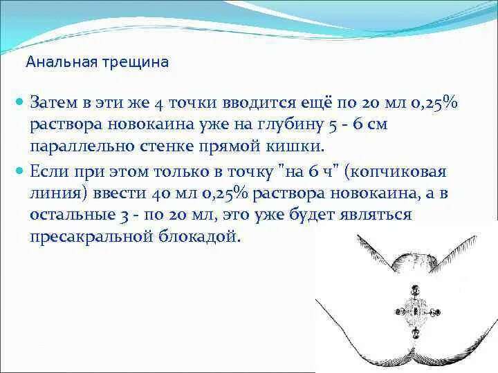 Трещина прямой кишки этиология. Анальная трещина классификация. Трещины прямой кишки диагностика лечение. Причины возникновения трещин заднего прохода. Трещина в заднем проходе кровоточит