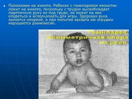 Ребенку месяц вялый