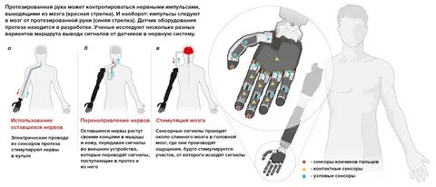 Протез состав