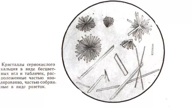 Иглы в моче. Соли фосфорнокислого кальция в моче. Кристаллы сульфата кальция в моче. Кристаллы мочевой кислоты микроскопия. Сернокислая известь в моче.
