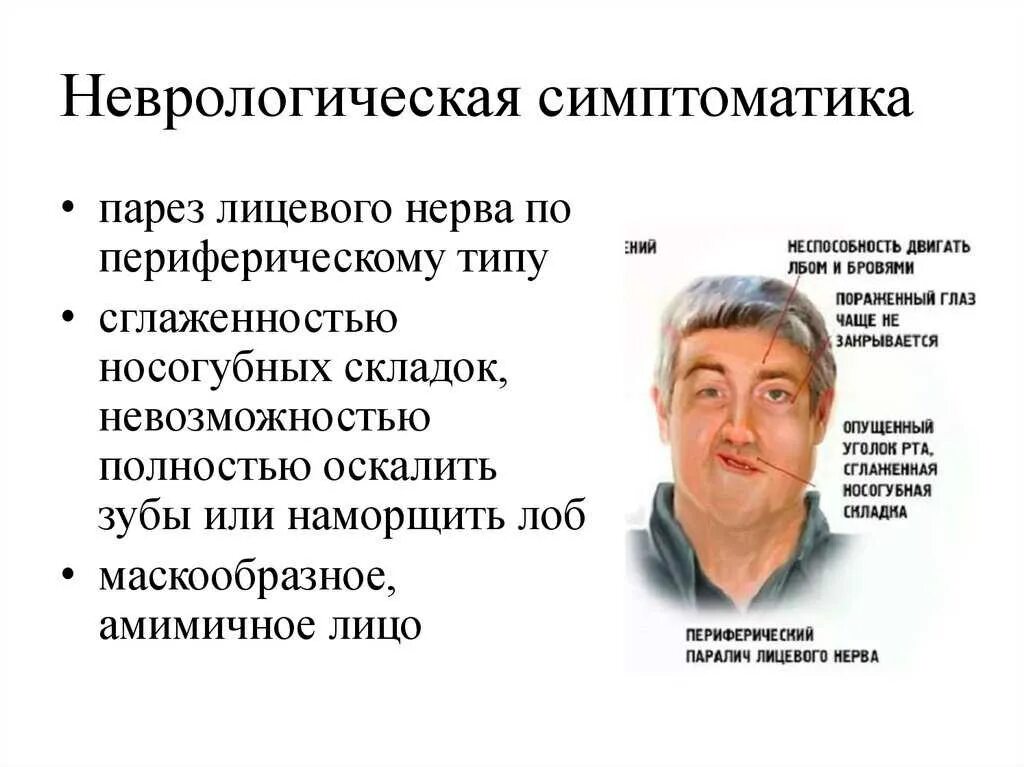 Паралич чувств. Неврологическая симптоматика. Признаки неврологии. Неврологические расстройства симптомы. Клинические проявления неврологических заболеваний.